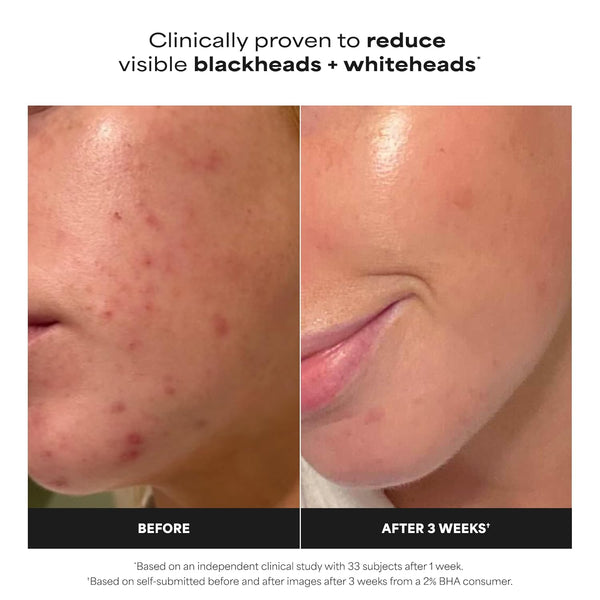 Radiant Glow Exfoliant
