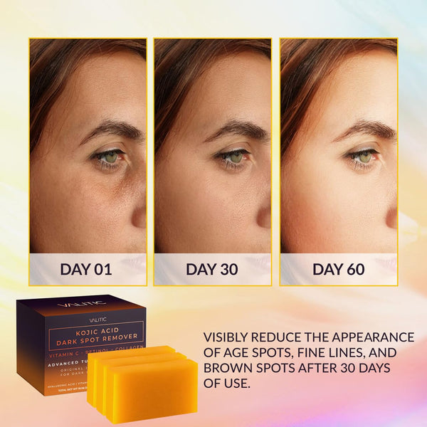 Radiant Glow Soap Bars